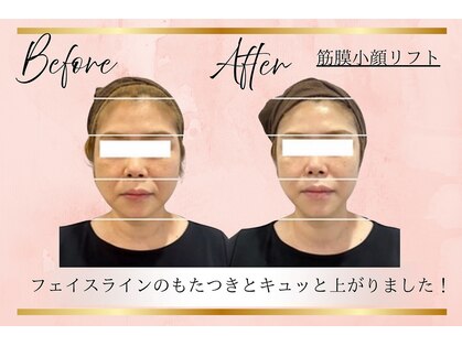 リーズリアン(Rises Lien)の写真