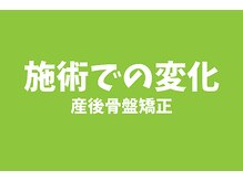ニノ治療院(Nino治療院)/産後骨盤矯正を受けた変化