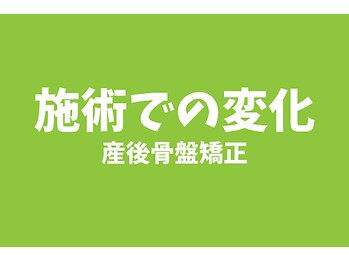 ニノ治療院(Nino治療院)/産後骨盤矯正を受けた変化