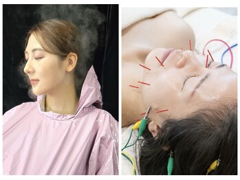 マグノリアの写真/次世代よもぎ蒸し&美容鍼で理想の小顔へ!むくみ・滞り解消で速攻持続性◎!