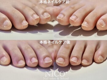 ニコプラス(NICO+)/フット爪育ネイルケア