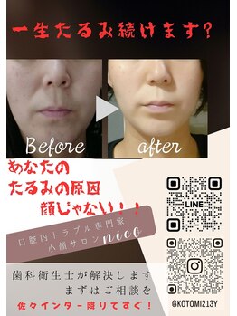 ニコ(Nico)/このまま老化したくない方へ