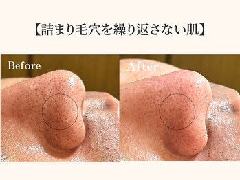 ドリームスパ 町田店(DREAM SPA)/before→after