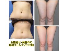 庭夢エステの雰囲気（計算された施術で3回の変化に感動！短期集中で理想の美ボディへ）