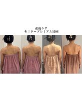 ロココ 豊田店(Rococo)/ビフォーアフター