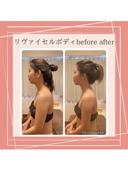 ニアベル(Nia Belle)/リヴァイセルボディ
