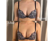 サロン ド ガーネット(Salon de Garnet)/バストアップ☆ビフォーアフター