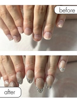 ピノ(pino)/◆深爪矯正＋長さだしアート◆