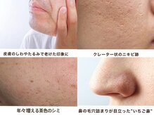 フルール(Fleur)の雰囲気（●メンズフェイシャル＆脱毛＆ネイルケア●清潔感UP好印象一直線）