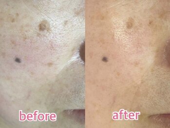 サクラ 伊勢原店(SAKURA)/大人のお悩みにも◎