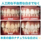 ホワイトニングカフェ 大阪ベイタワー 弁天町店
