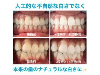 ホワイトニングカフェ 大阪ベイタワー 弁天町店