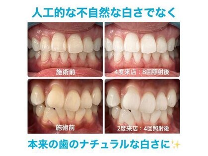 ホワイトニングカフェ 大阪ベイタワー 弁天町店の写真