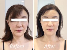 ドクターボディ 新宿店(Dr.Body)/【たるみ/歪み/左右差　50代】