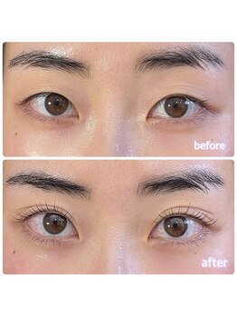 シピリカ(Shiprica.)/アイパワーエステ