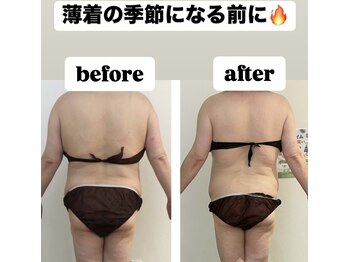 サロン ド モナ(salon de mona)/【後ろ姿ビフォーアフター】痩身