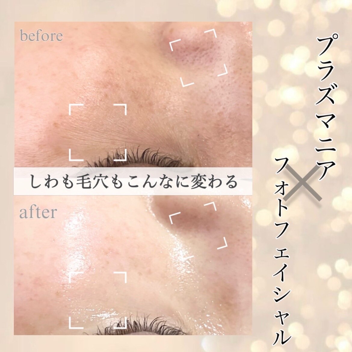 サロン ド ミエル 様❤専用ページ サロン ド ビューティージュエル(salon de beauty JEWEL