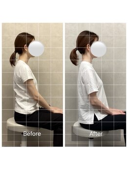 玉造駅前整体院/一度の施術でこの変化◎