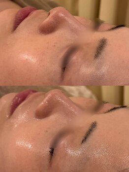 セレニテ(Serenite)/