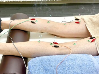 とだ鍼灸院/あしの痛み怠さ/冷え/浮腫みに！