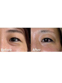 ユニ(Uni)/くまが気にならなくなった