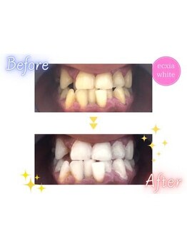 エクシアホワイト SOKA(ecxia white)/