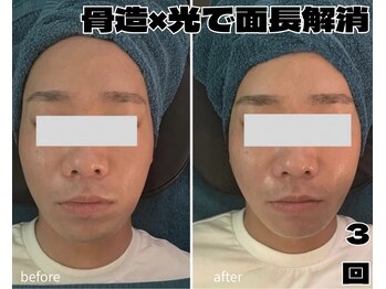 アンドワイ バイ サロンリーナ(&y by Salon Lena)/【メンズ骨造×光】