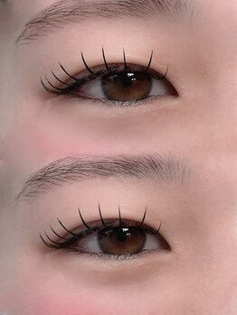 アテ(ate.)/アンドヘルシー80本