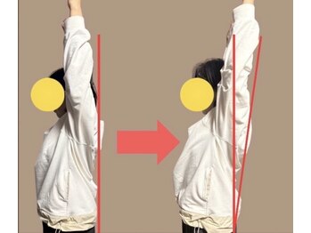 ローリエ/日常に支障が出る肩こりが楽に