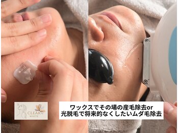 クリアホワイト(Clear White)/ワックスor脱毛