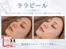 フィル(fill.)
