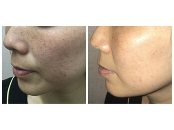 メディカルサロン アヴェニール(Avenir)/ドクターリセラADS