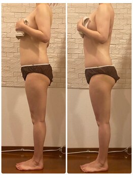 うつくし痩身 美サロン ゼットワン(Z-ONE)/メディセル＋パイラソード90分