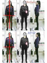 姫路なごみ整体院 なごみ鍼灸院/(改善例)右首の痛み