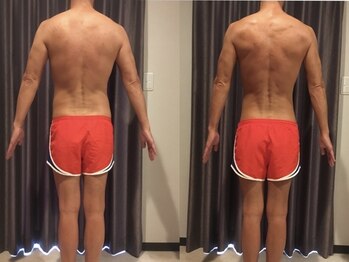 ルギニ(LU.GINI)/痩身エステ・ビフォーアフター後