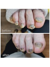 爪切り屋 足楽/