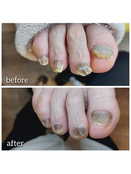 爪切り屋 足楽/