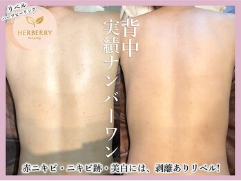 アッシュ 梅田(H)/ハーブピーリング専門Hアッシュ