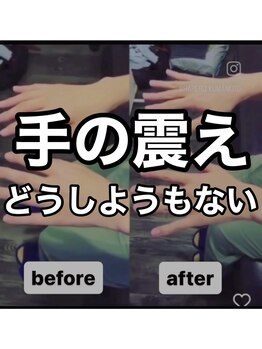 カワル整体 上通り院/どうしようもない手の震え