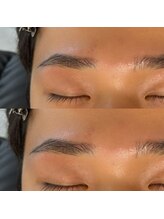 ブリス 姫路(Bliss)/お客様Before/After