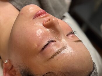 キュレイテッドスキン(CURATED SKIN)/ピーリング/肌質改善/プラズマ