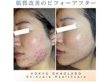 コキュウ(KOKYU)の雰囲気（20～60代幅広い年代の方に/清潔でリラックスできる空間をご用意）