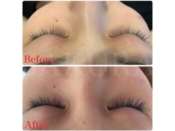 エステティックサロン サクラ(SAKURA)/自まつ毛が伸びる！増える！