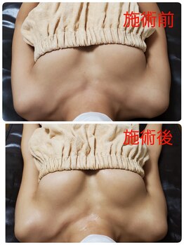 ビープラス(B+)/上:before 下:after