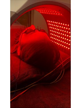 すぎ/美容鍼＋コラーゲンライト