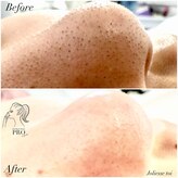 ジョリエストワ(Joliesse toi)