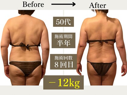 リウル(RiUll)の写真