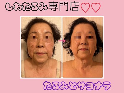 トルル(Tlulu)の写真
