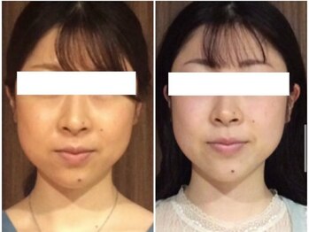 美容整体 ウェリナ 蟹江院/小顔矯正/骨盤矯正/美脚サロン