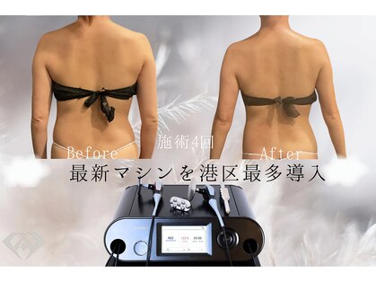 アージェム(AGEM)の写真